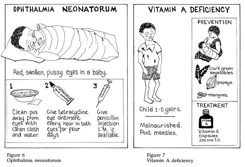 vitamin b complex