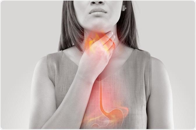 Understanding Acid‌ Reflux: Symptoms and Triggers