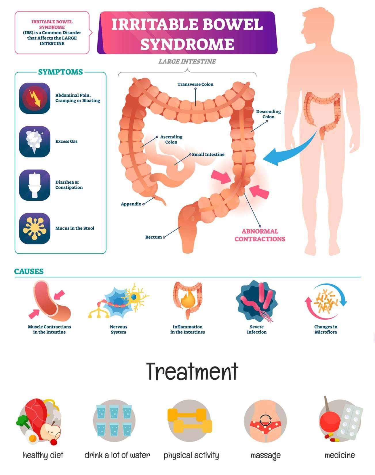 irritable bowel syndrome treatments