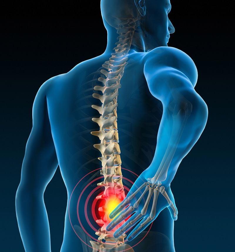 Understanding the Causes of Back Pain ⁢for Effective ​Relief