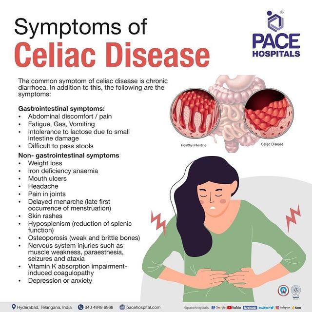 Understanding Celiac Disease: An Overview of Causes and‌ Symptoms