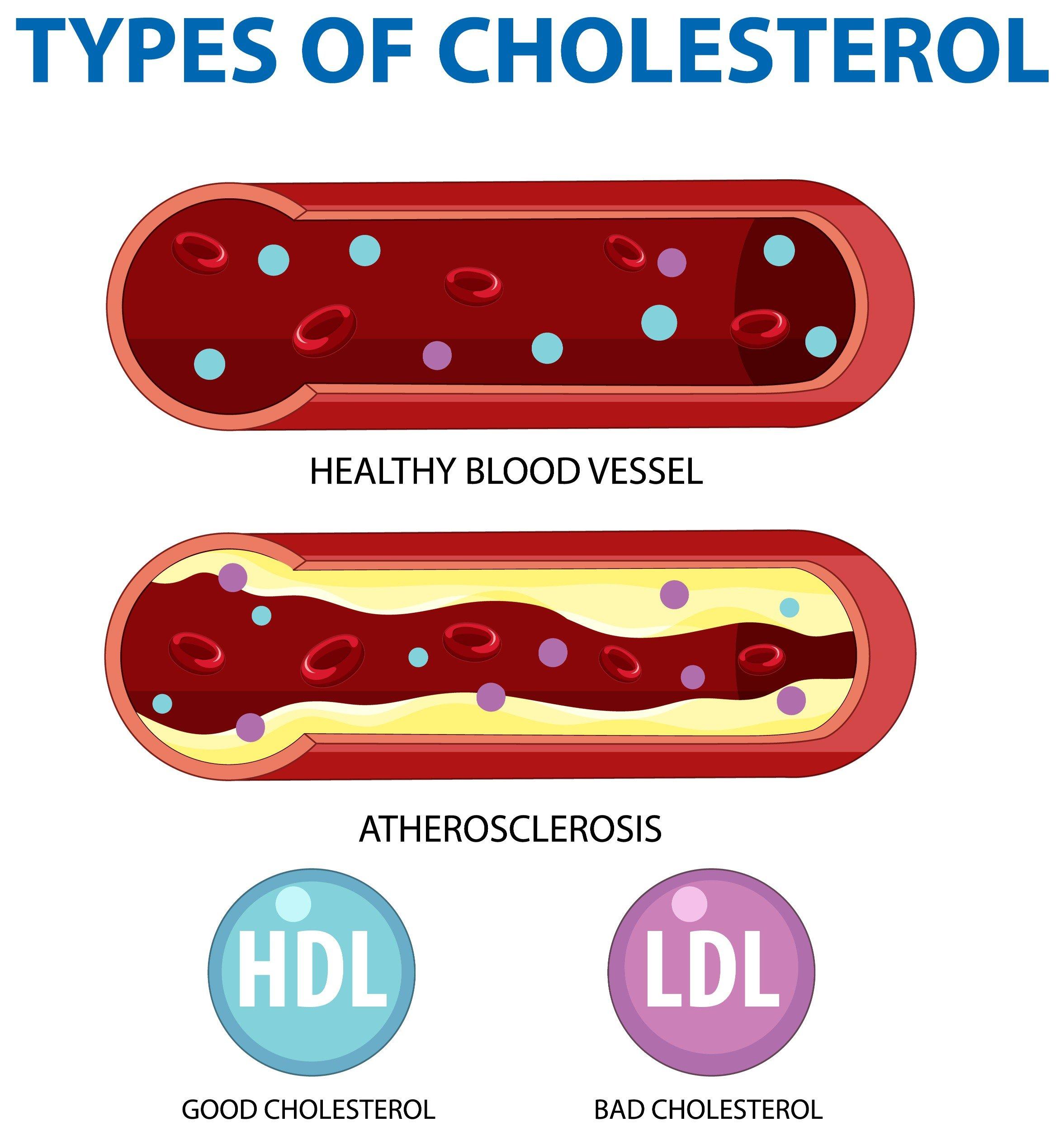 ldl ‌cholesterol